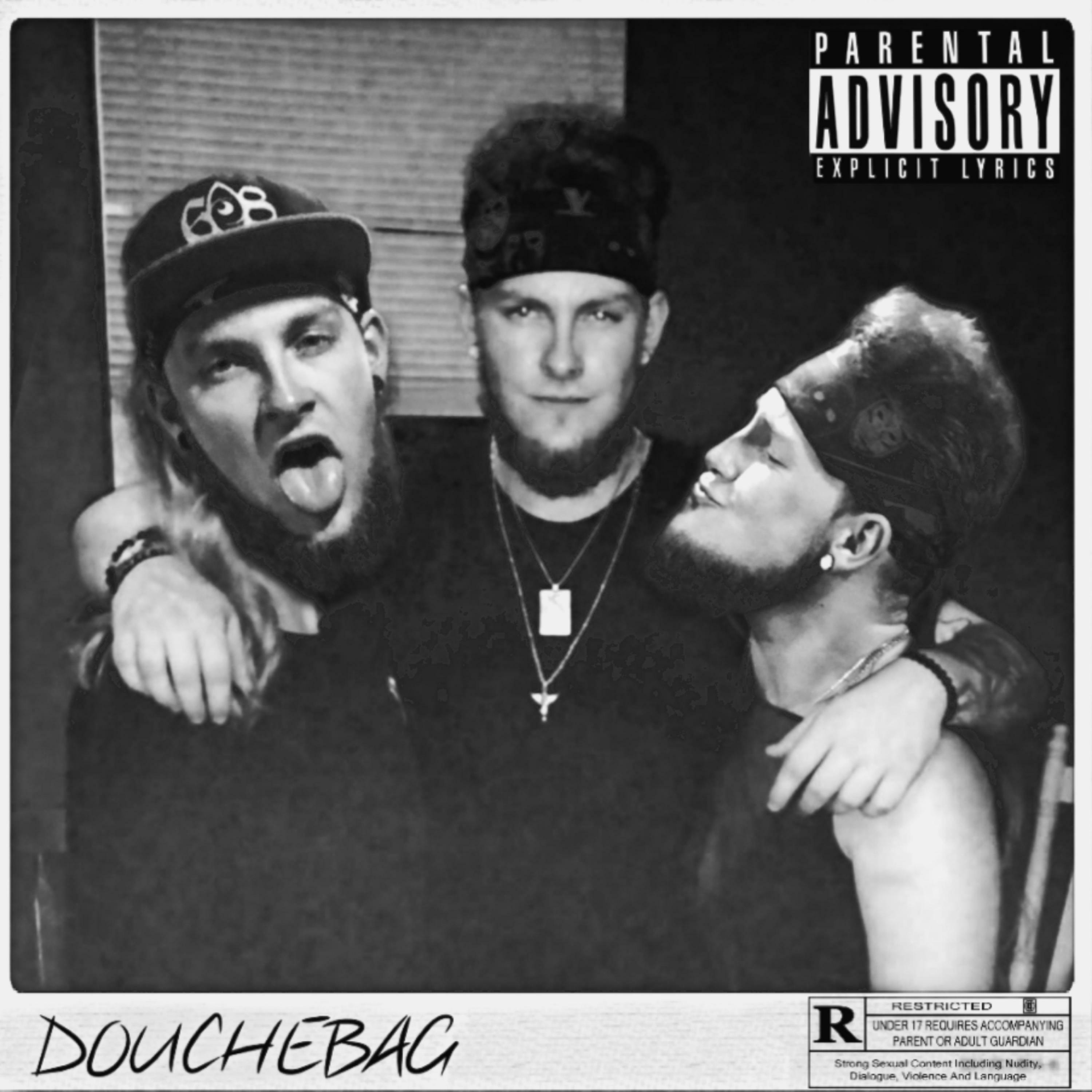 Ace Wild Douchebag iHeart